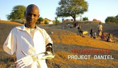 «Daniel Project» : Quand l’impression 3D redonne espoir aux amputés du Sud Soudan