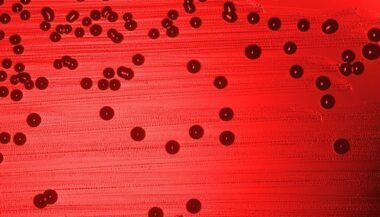 De la difficulté de la lutte contre l'hémophilie au Maroc