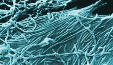 Ebola: deux cas suspects détectés au Mali