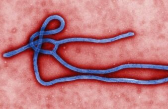 Ebola dévaste l’économie africaine