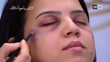 &ldquo;Camouflage de sévices corporels&rdquo;: 2M reçoit un avertissement