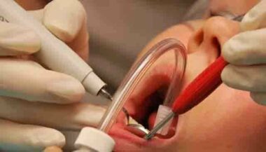 Oued Laou: décès d’un enfant après extraction d'une dent chez un prothésiste