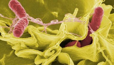 Salmonelle au Maroc, une situation inquiétante mais pas alarmante