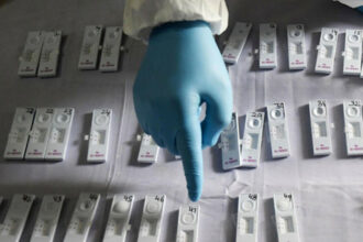 Les tests d’orientation rapide seront-ils disponibles en pharmacie ?