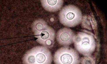 Santé publique: 20 ans et toujours pas de cadre réglementaire contre les mycotoxines