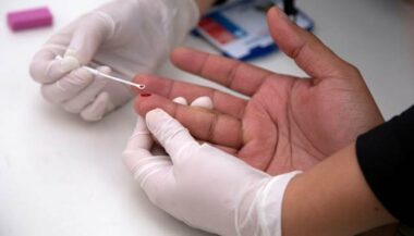 Sida: trois porteurs du virus sur cinq dans le monde ont maintenant accès aux traitements