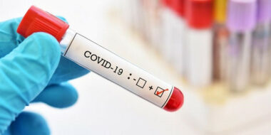 Omicron : les raisons d'espérer (experts)