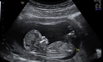 Une revue scientifique publie une étude confirmant la solution de la start-up DeepEcho