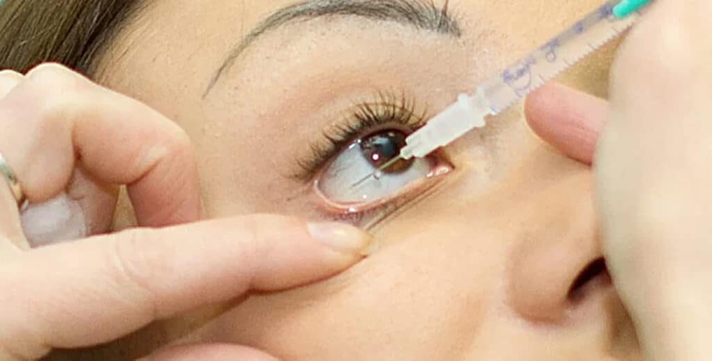 Santé oculaire : quand l’absence de cadre prive les Marocains d’un traitement efficace